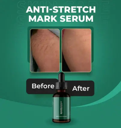 Markaway Stretch Mark Serum Herbal Formula for Scars & Skin Elasticity 30ml Nourishing, Repairing & Firming Skin Treatment Herskin.PK